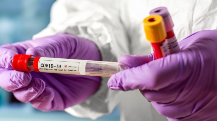 На Рівненщині за добу виявили 206 хворих на коронавірус