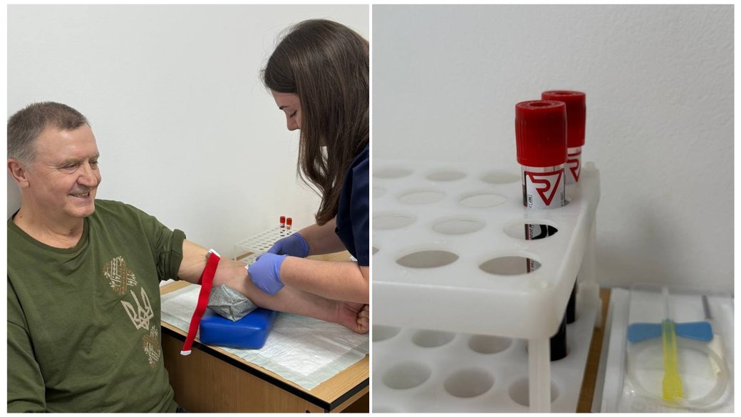 У Рівненський протипухлинний центр запрошують чоловіків: здати аналіз крові на PSA 