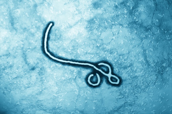 Вірус Ебола може ховатися в мозку роками і викликати рецедив
