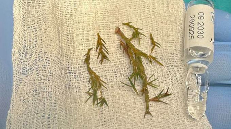 Врятували хлопчика, який мало не задихнувся від гілок ялинки