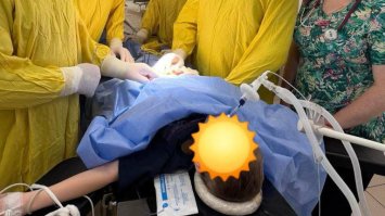 Хлопчик проковтнув 17 магнітів: лікарі його врятували