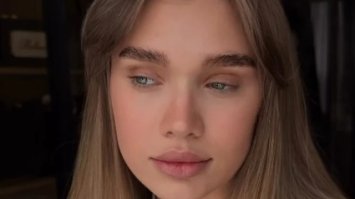 Наслідки підтяжки обличчя: у блогерка Саші Бо випадає волосся