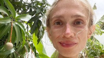 Померла від недоїдання: полька харчувалася лише фруктами й важила 27 кг