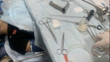У Львові польські лікарі провели одразу декілька складних операцій дітям