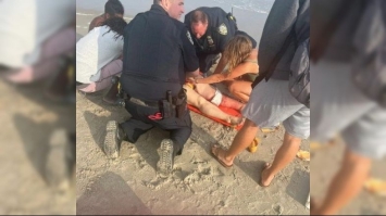 У Нью-Йорку акула напала на українку