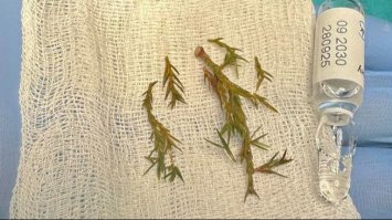 Врятували хлопчика, який мало не задихнувся від гілок ялинки